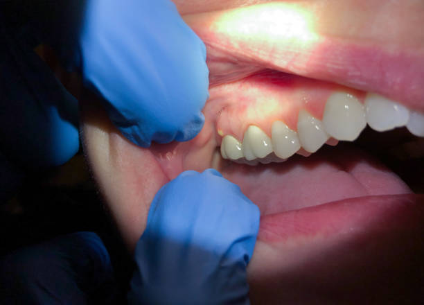 Best After-Hours Emergency Dentist in Camp Barrett, VA