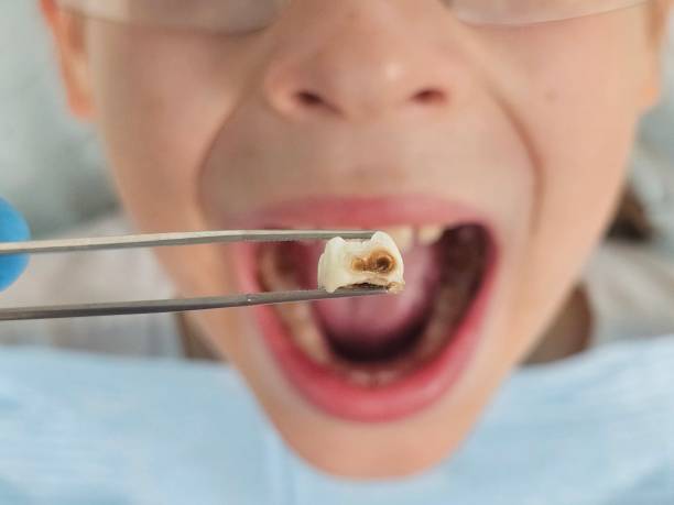 Best Urgent Dental Care in Camp Barrett, VA